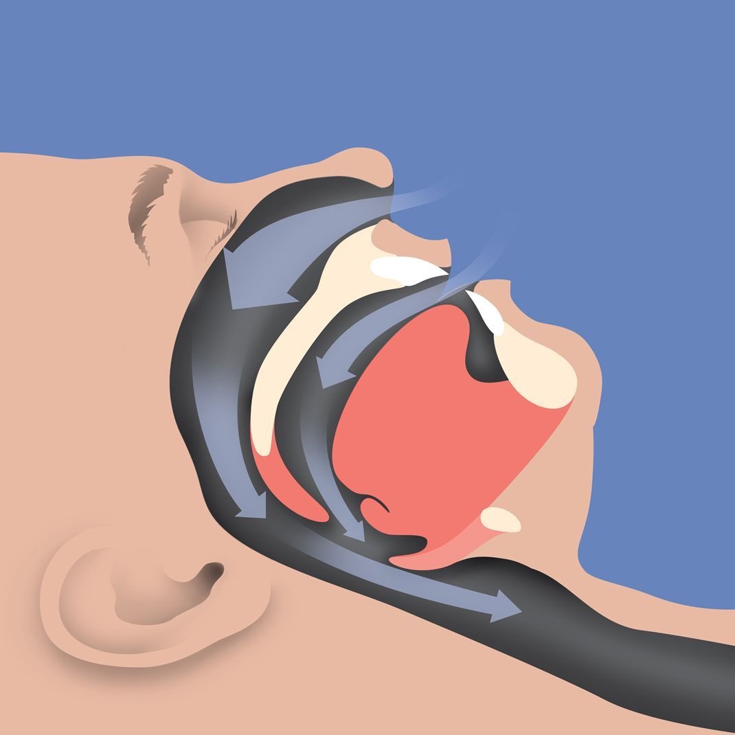 fully open breathing way